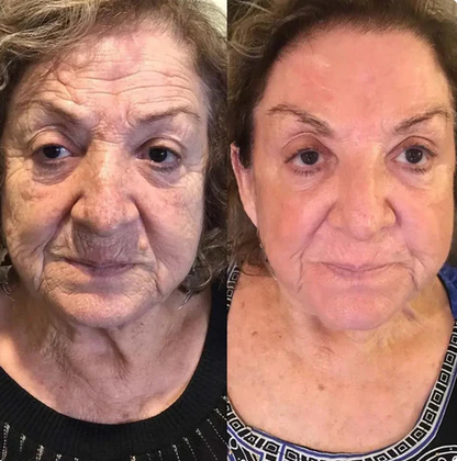 Orivelle Toning Whip