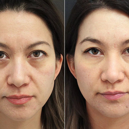 Instant Eye Tightening Cream