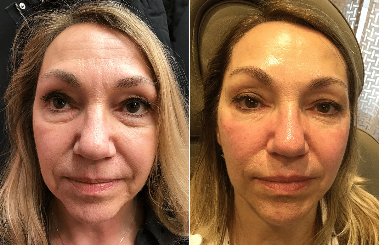 – Alyssa M., New York